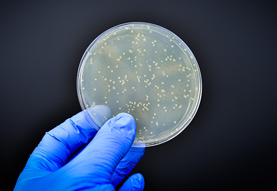 Hand with blue glove holding petri dish with bacteria in it