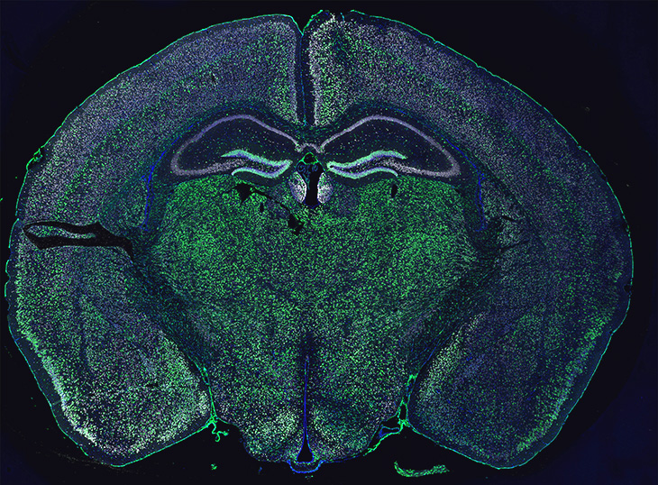 Obraz akumulacji rybosomalnych neuronów reporterowych (na zielono) w mózgu dorosłej myszy