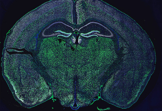 Image of neuronal accumulation of ribosomal reporter (in green) in the brain of adult mouse
