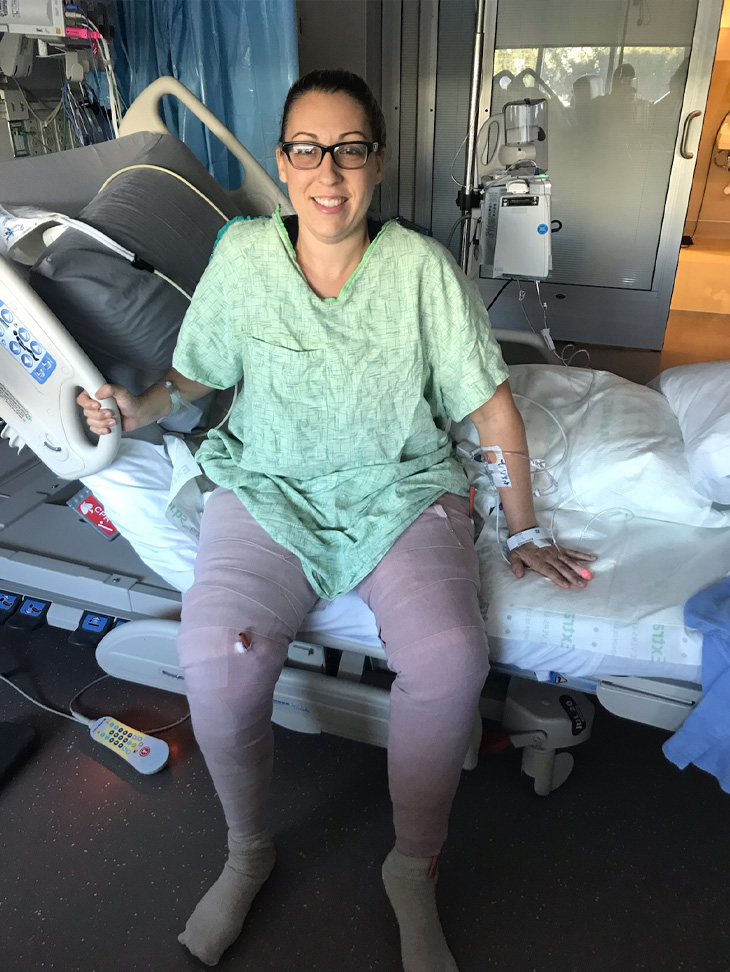 Dani Taylor sitting on side of hospital bed with bandages covering both legs