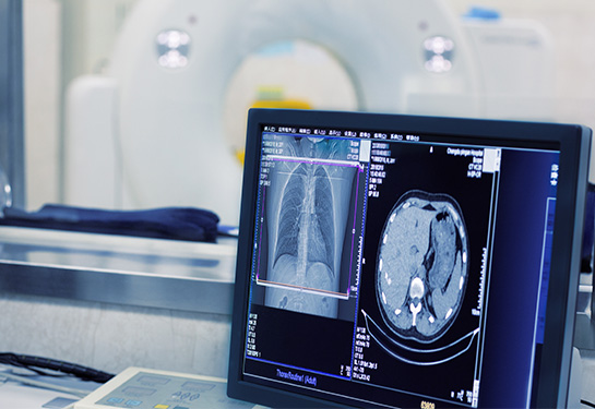 image of a CT scan on a computer screen