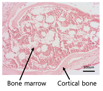 bone marrow