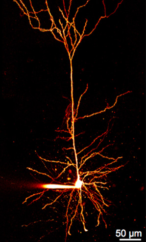 A pyramidal neuron filled with fluorescent dye 