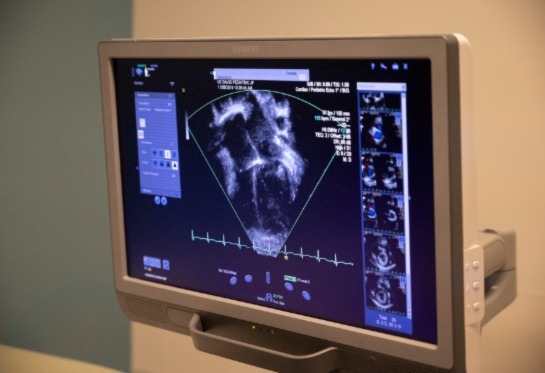 Computer with echocardiogram on the screen