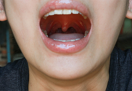 Person with mouth open looking down their throat