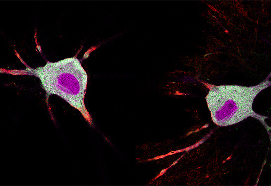 Two neurons with light green central bodies with bright magenta spots are shown against a dark background. 