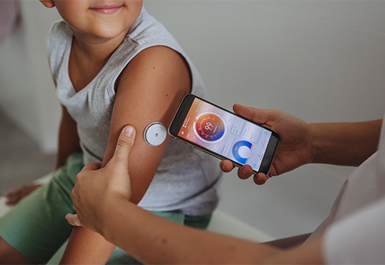 Un niño con diabetes chequea su nivel de glucosa en la sangre en su casa usando monitoreo continuo de glucosa. 