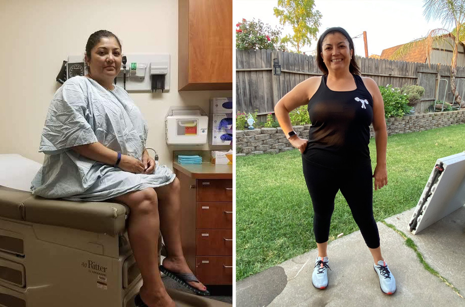 Left: Obese woman in hospital gown sitting on examination table; right: same woman after losing 100 pounds and wearing workout attire.