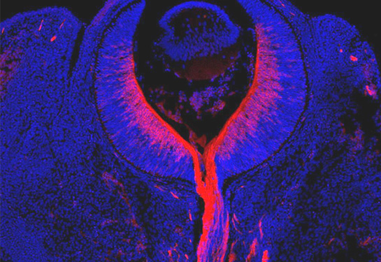 Electronic image of the retinal ganglion cells (in red) in the retina of a mouse.