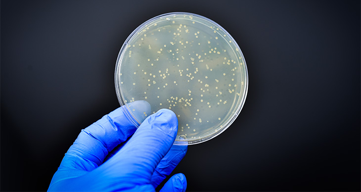 Hand with blue gloves is holding a petri dish with many small yellow dots. 