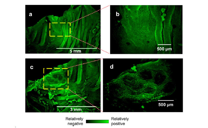 Gut bioelectricity provides a path for bad bacteria to cause diseases