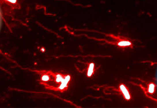 The electrical field-guided migration of S. Typhimurium as shown by immunostaining