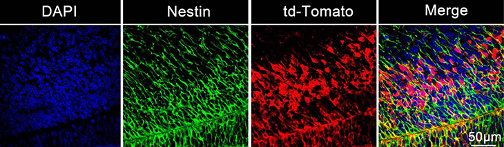 Four slides showing transfected fetal brain stem cells in blue, green, red, and combined