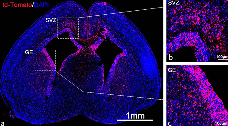 Gene editing of the cells within the subventricular zone (SVZ), the SVZ and the ganglionic eminence (GE). 