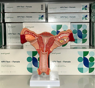 Plastic model of a cervix positioned in front of a stack of small boxes that are labeled 