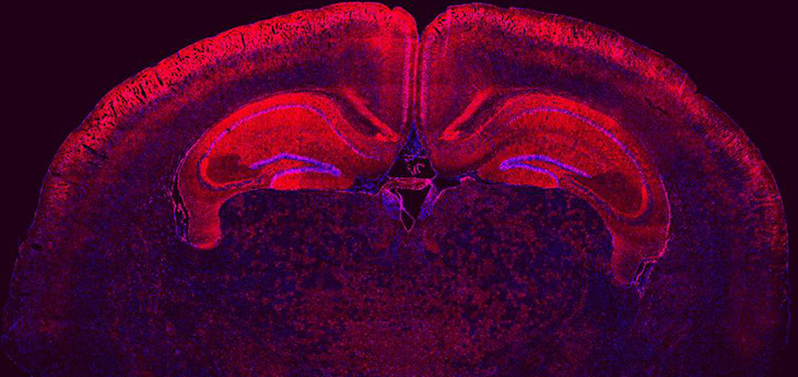 Widespread of transfected cells in the brain by in utero delivery Cre mRNA 