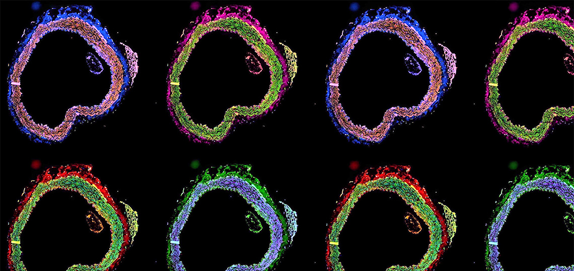 Composite images of a cross-sectional aortae