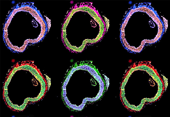 Composite images of a cross-sectional aortae