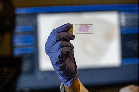 A slide with a stained sample of brain tissue