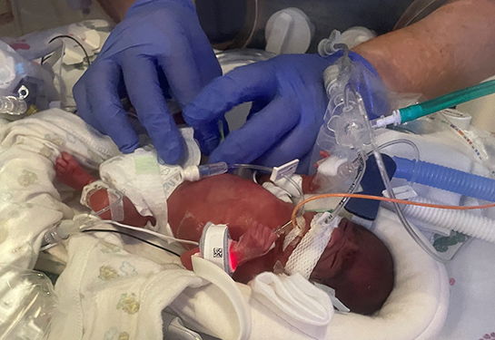 Small baby in NICU held by gloved hands