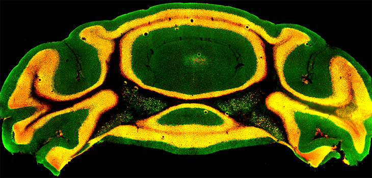 Kawałek komórek móżdżku myszy, wybarwiony fluorescencyjnym pomarańczowym. 