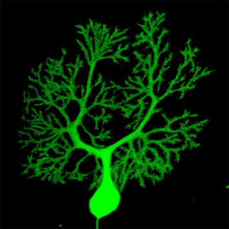 A slide of a single Purkinje cell in the cerebellum, stained green on a black background