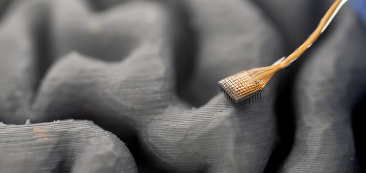 UC Davis neurosurgeon David Brandman has received the 2026 NIH Director’s New Innovator Award to develop a brain-computer interface that can help rest