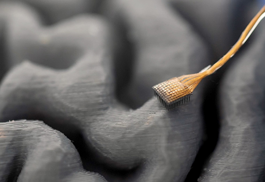 UC Davis neurosurgeon David Brandman has received the 2026 NIH Director’s New Innovator Award to develop a brain-computer interface that can help rest