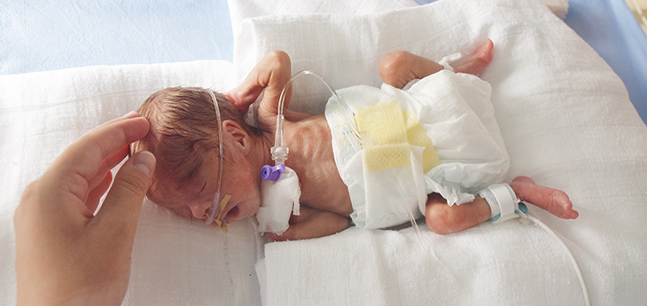 A baby lies in the Neonatal Intensive Care Unit