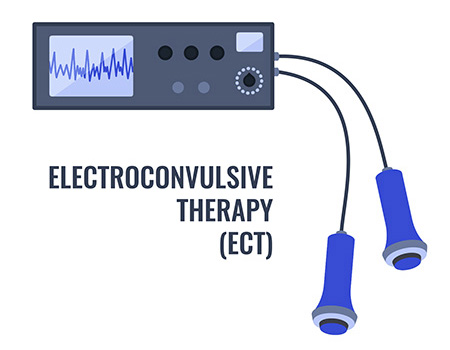 Illustration of an ECT machine and electrodes used in electroconvulsive therapy.