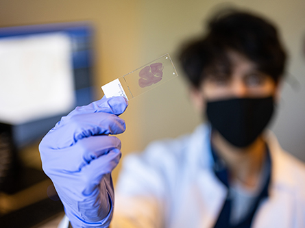 UC Davis Health pathology lab researcher holding sample