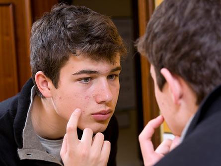 teen boy looking at his acne in the mirror