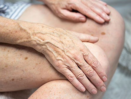 woman's hands and legs with some age spots