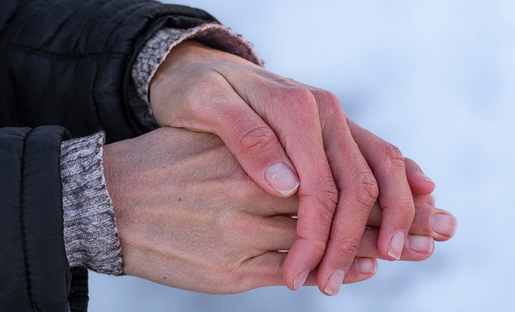 red and dry hands in cold winter weather