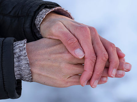 person's hands looking red and dry in winter weather