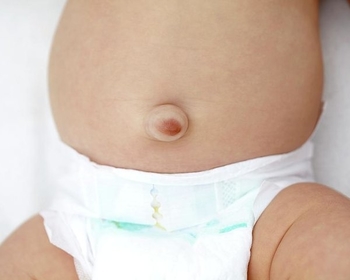 What's with the bulge? Hernias in children