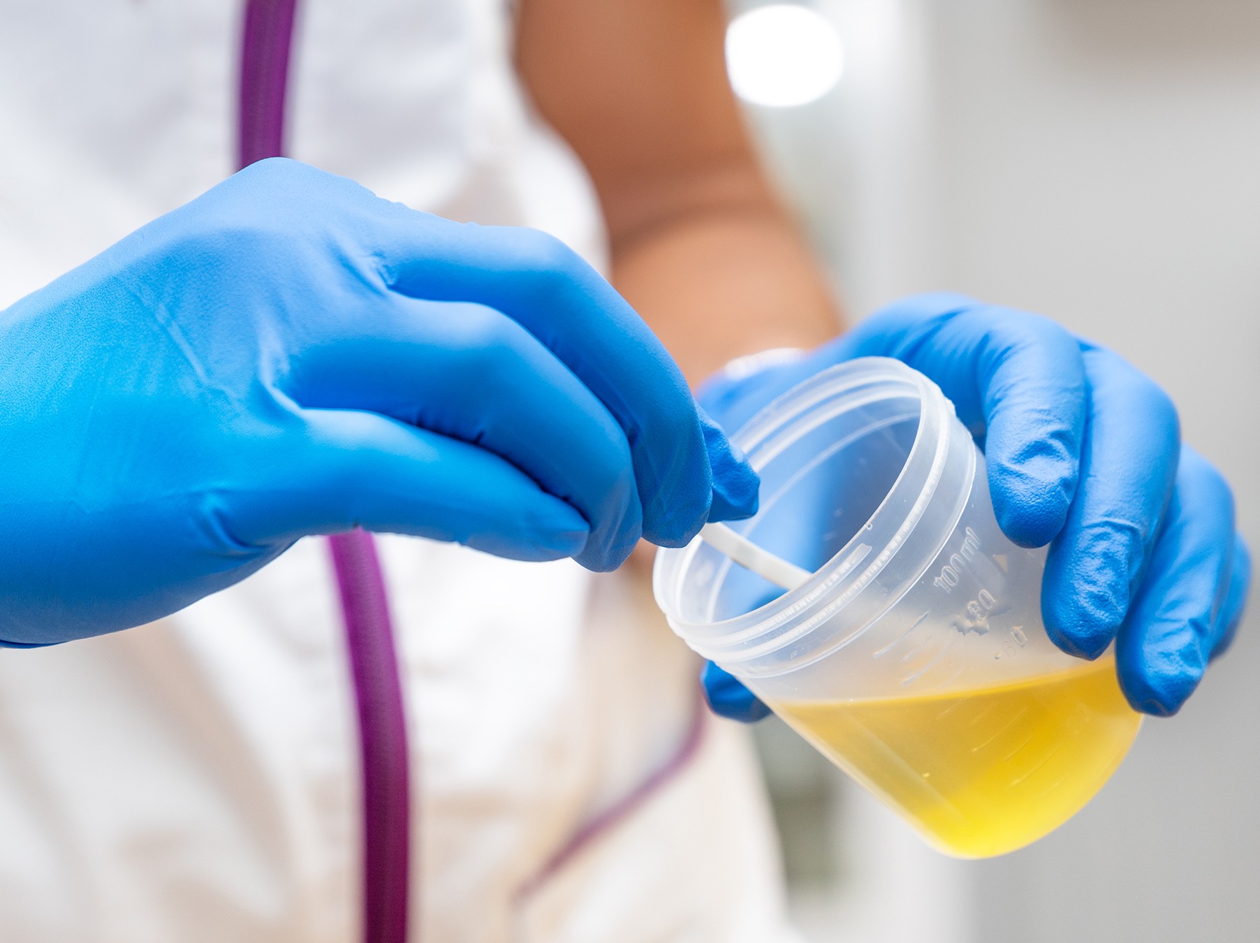 urine collection cup