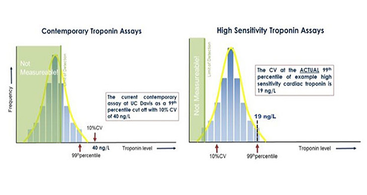 Differences in 99th Percentile Cut-Offs for Contemporary vs. High Sensitivity Assays