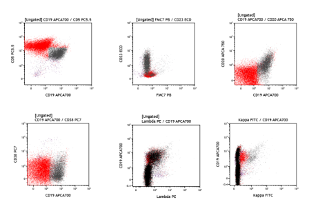 Chronic lymphocytic leukemia