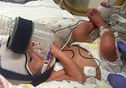 A baby connected to multiple medical tubes and sensors.