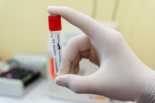 A gloved hand holding a test vial labeled COVID-19 marked positive. 
