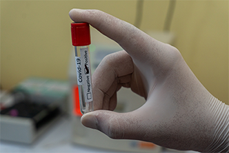 test tube with positive COVID-19 result