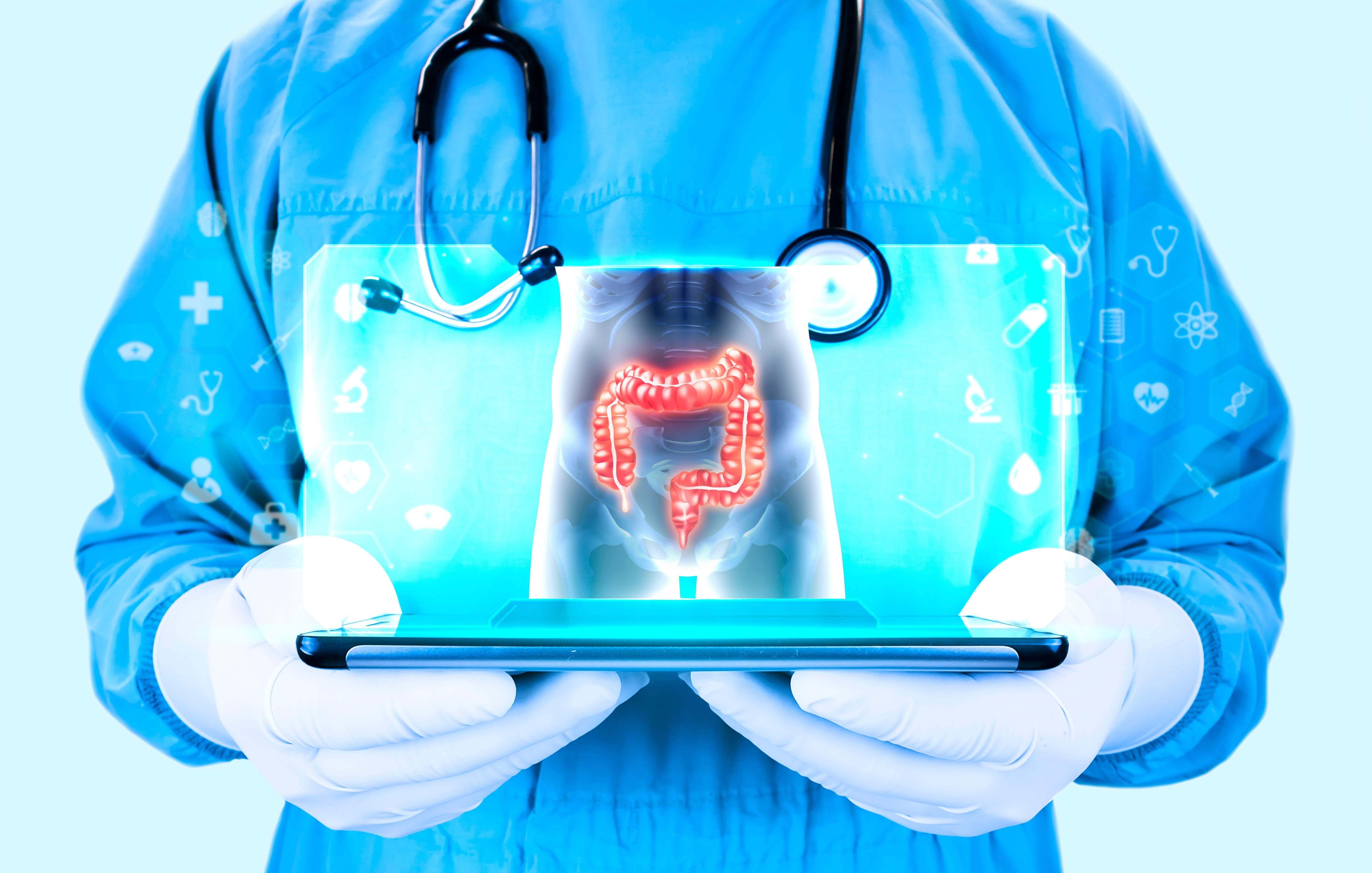 Illustration of intestines on laptop screen.