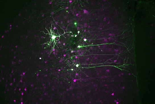 Magnification of neurons from study