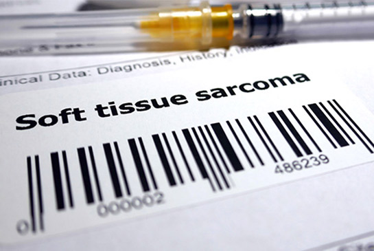 Sarcoma 