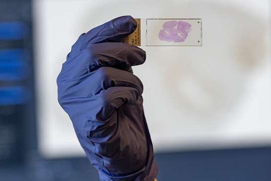 Gloved hand holding a microscope slide.