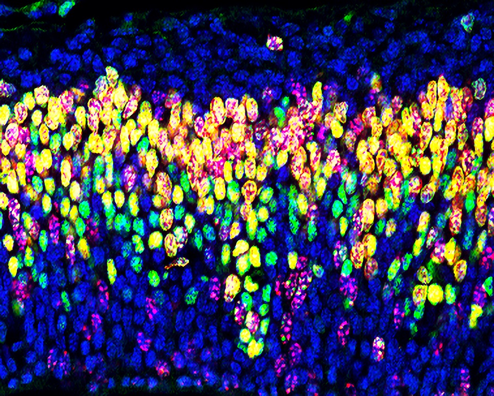 Microscopy image depicting a section of the mouse embryo cortical brain imaged using confocal microscopy