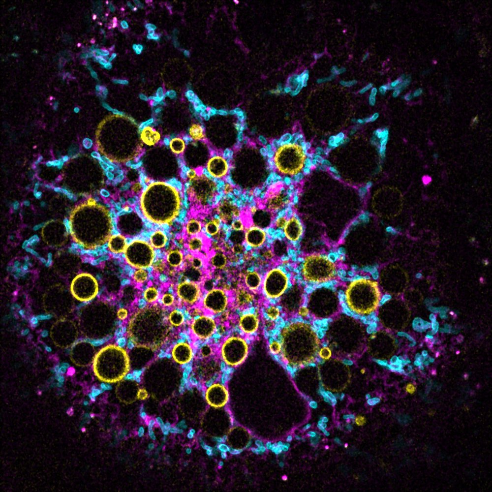  “Confocal image showing membrane contact sites