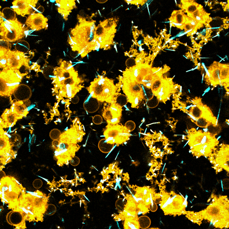 Microscopy image showing numerous bright golden-yellow cell-like structures scattered across a black background. 