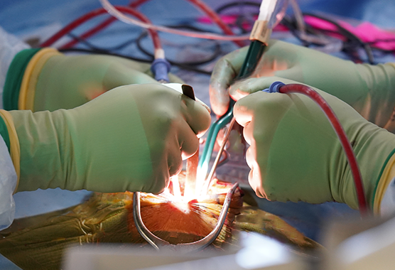 hands performing surgery